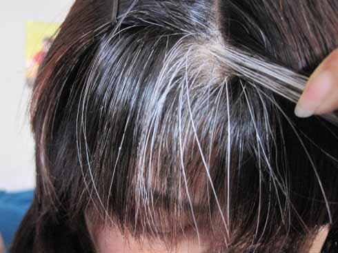 為什麼會有白頭發？