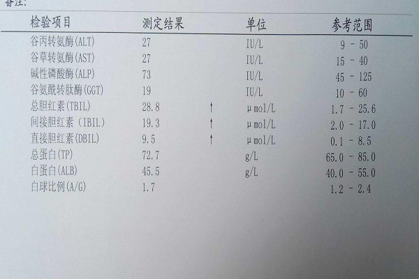 總膽紅素高是怎麼回事 總膽紅素高是什麼原因