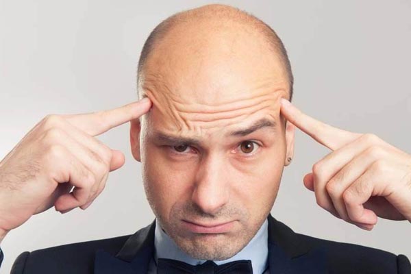 禿頂男性更易患心臟病