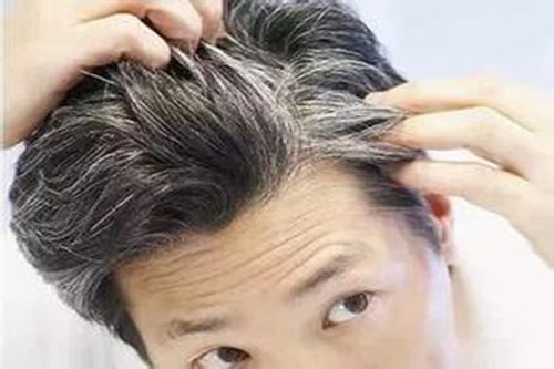 如何預防黑發變白