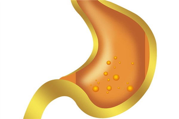 急性腸胃炎