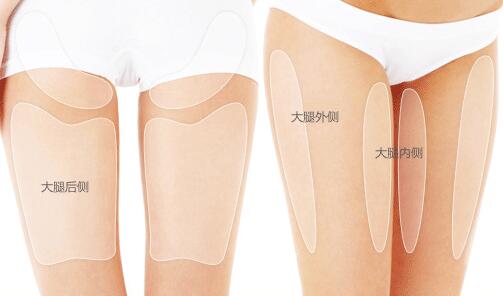 吸脂瘦大腿
