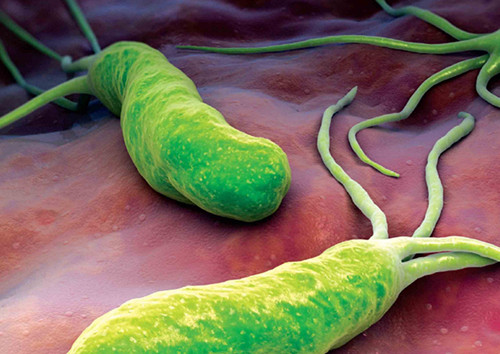 幽門螺旋桿菌抗體陽性是怎麼回事兒