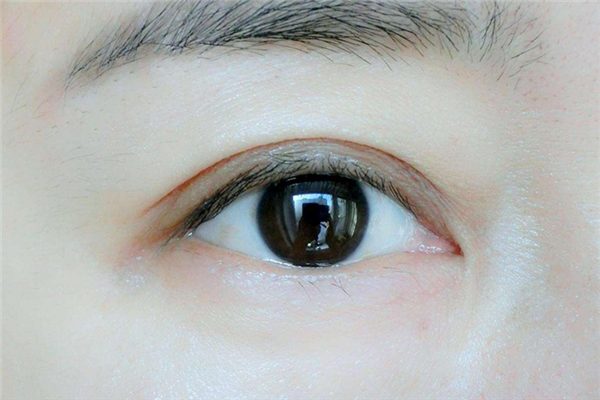 雙眼皮貼