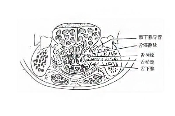 舌下腺囊腫癥狀_舌下腺囊腫手術費用_舌下腺囊腫吃什麼藥