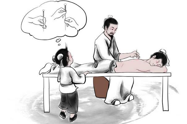 五行針灸：一種非常古老而神奇的針灸方法