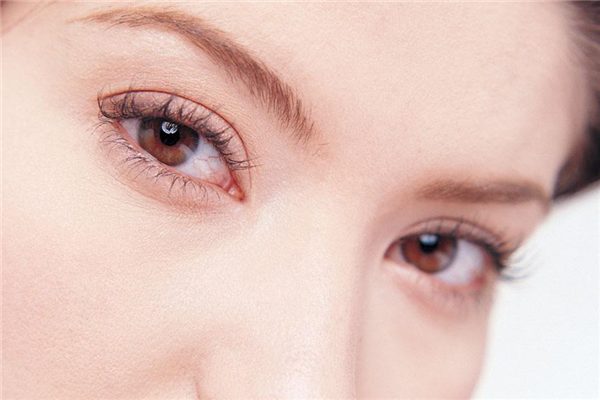腫泡眼如何做雙眼皮