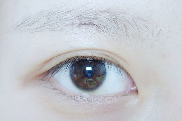 開眼角眼睛會變大嗎？