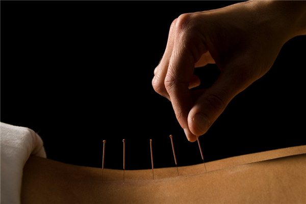 針灸