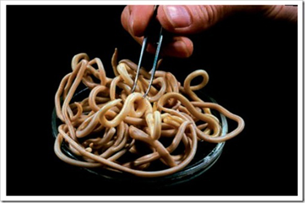 肚子裡有蛔蟲的癥狀 肚子裡有蛔蟲怎麼辦？