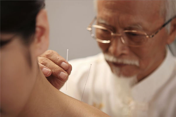 針灸減肥 中醫最推崇的健康減肥方式