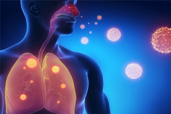 肺癌的最佳治療方法_治療_吃什麼