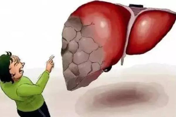 乙型病毒性肝炎患者日常護理