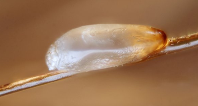如何防止虱子卵的出現