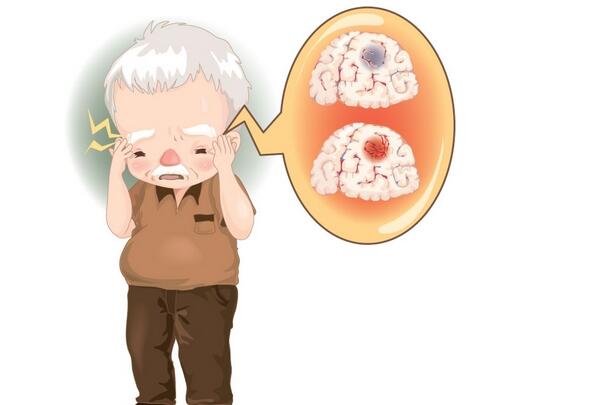 冬季腦血管病高發 多吃“紅色食物”巧預防