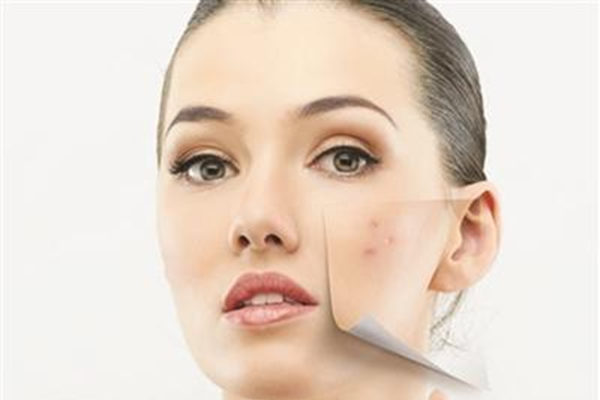 多吃多滅痘的食物名單