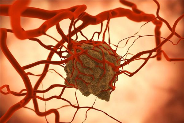 癌癥的早期癥狀_癌癥如何預防 癌癥