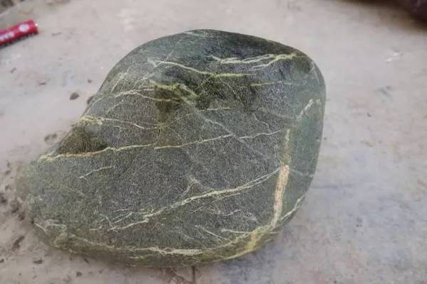 膽結石自然療法 膽結石不能吃什麼