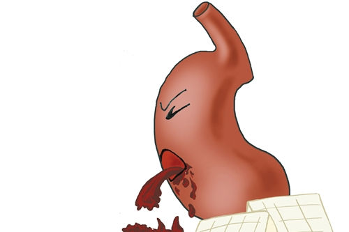 預示胃癌的五種信號 大傢要當心瞭!