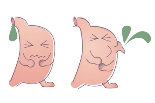 胃癌誘發重要因素有5種!還不快看看?