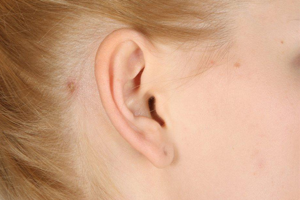 外耳道炎怎麼調養_如何調養外耳道炎_外耳道炎的飲食註意