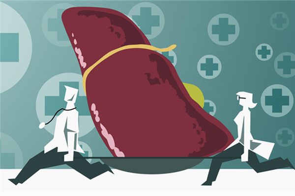 脂肪肝的自然療法_脂肪肝如何消除 脂肪肝