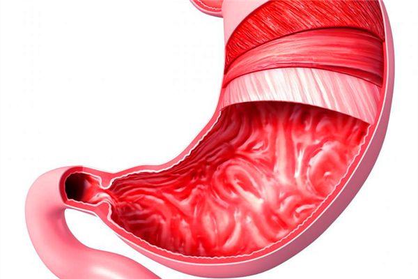 急性腸胃炎