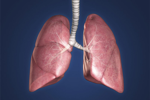 肺結核引發肺癌幾率達30%