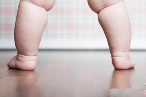 幼兒單純性肥胖癥如何預防