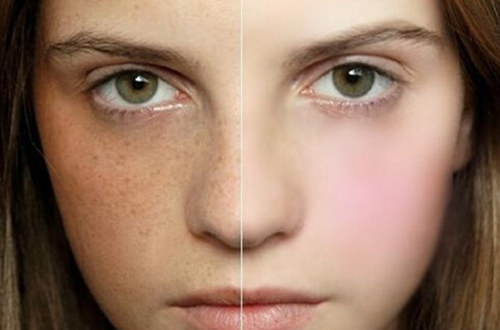 臉色暗沉氣色不好 按面色分別來調理