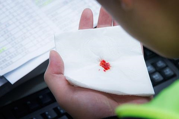 肺癌咳血怎麼辦?應該註意哪些飲食原則?