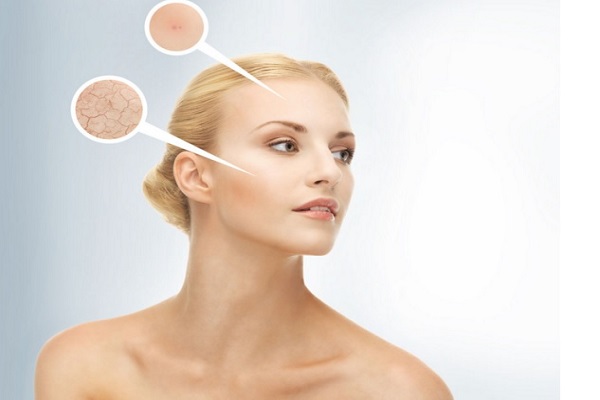 皮膚幹燥癥簡介 綜合幹燥癥如何治療