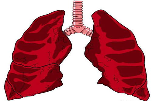 你想知道的有關肺癌的知識 都在這裡